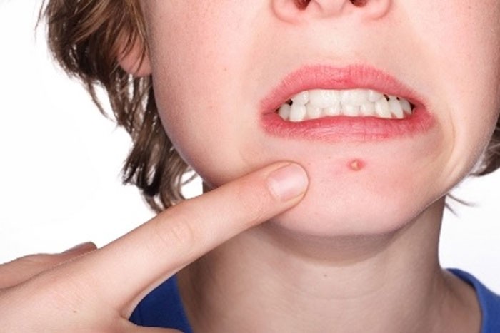 Батга гаргадаг гол 5 хүнсний бүтээгдэхүүн